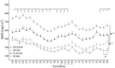 Gender-Related Impact of Sclerostin Antibody on Bone in the Osteogenesis Imperfecta Mouse